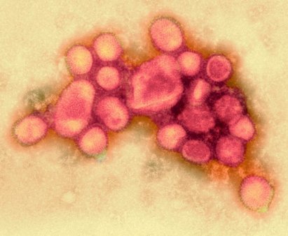 O fetita in varsta de 11 ani a murit din cauza gripei aviare in  prima infectie umana cu H5N1 cunoscuta in <span style='background:#EDF514'>CAMBOGIA</span> din 2014 . Avertisment al autoritatile sanitare