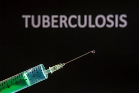 Ziua Mondiala de Lupta impotriva Tuberculozei: In Romania sunt aproximativ 30.000 de bolnavi