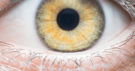 Alzheimer poate fi detectat in ochi. <span style='background:#EDF514'>CONCLUZII</span>le celui mai recent studiu