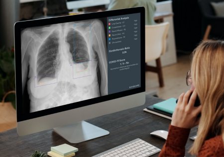Medicii MedLife atrag atentia asupra importantei investigatiilor imagistice in diagnosticarea cancerului pulmonar si explica rolul inteligentei artificiale in acest proces