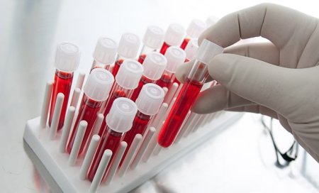 Greseli care pot influenta rezultatele analizelor de sange, inclusiv diagnosticul