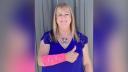 O femeie din Texas a fost ranita dupa ce un soim a scapat un sarpe pe ea