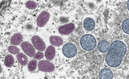 China va gestiona variola <span style='background:#EDF514'>MAIMUT</span>ei in aceeasi clasa de boli infectioase cu COVID-19