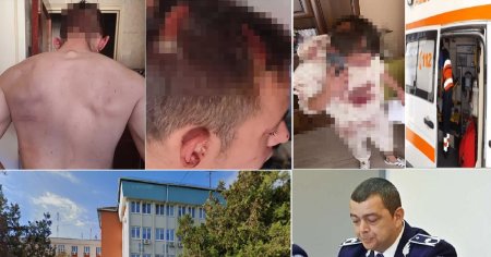 <span style='background:#EDF514'>ULTRAJ</span> si abuz in serviciu la Sibiu. Un tanar care s-a opus unei legitimari s-a ales cu capul spart