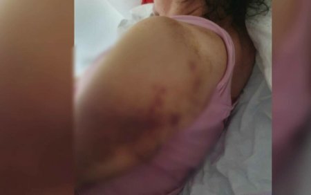 O femeie din Mures, dusa la spital cu gripa, are acum <span style='background:#EDF514'>FRACTURI</span> la umeri si nu-si poate misca bratele