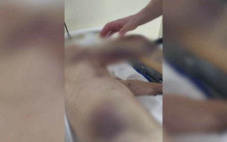 Un barbat s-a ales cu fracturi si vanatai dupa ce a fost transferat intre doua spitale. Fiul crede ca a fost scapat