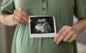 Cum afecteaza fibromul uterin sarcina. Dupa o luna de la indepartarea acestuia, e posibil sa apara sarcina in mod natural