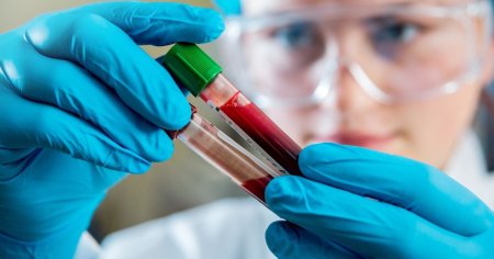 Oamenii de stiinta au descoperit o gena care poate creste riscul de cancer al sangelui