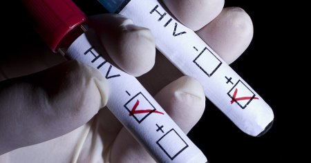 Un studiu recent indica faptul ca medicii ar putea tine efectele infectarii cu HIV sub control