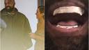 <span style='background:#EDF514'>KANYE WEST</span> si-a pus dinti din titan. Imagini cu lucrarea care l-a costat 850.000 de dolari