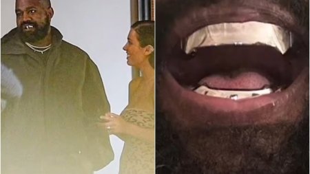 Kanye West si-a pus dinti din titan. Imagini cu lucrarea care l-a costat 850.000 de dolari