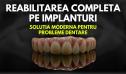 O Solutie Moderna pentru Probleme Dentare: Reabilitarea Completa cu <span style='background:#EDF514'>IMPLANTURI</span>