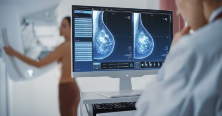 Cercetatorii au descoperit un potential tratament impotriva cancerului mamar agresiv