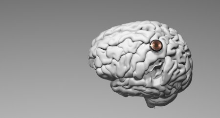 Primul chip Neuralink implantat intr-un creier uman a fost un succes. Pacientul a miscat un mouse cu ajutorul mintii