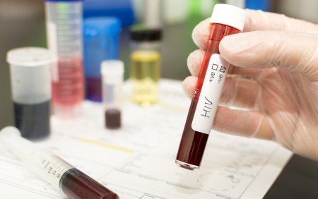 O femeie a primit despagubiri de 145.000 de euro dupa ce a contractat HIV intr-un laborator de cercetare