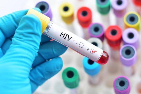 O italianca a primit 145.000 de euro, dupa ce s-a infectat cu HIV intr-un laborator din Geneva