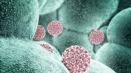 Datele INSP care arata legatura dintre cazurile de cancer diagnosticate in Romania si infectia cu virusul HPV
