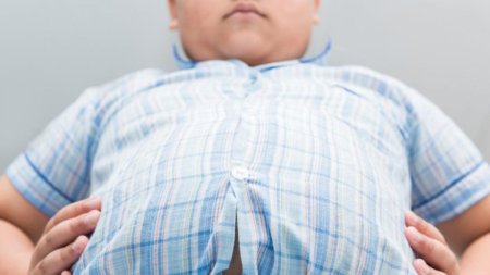 Pandemie de <span style='background:#EDF514'>OBEZITATE</span>. In trei decenii, numarul copiilor obezi a crescut de peste cinci ori