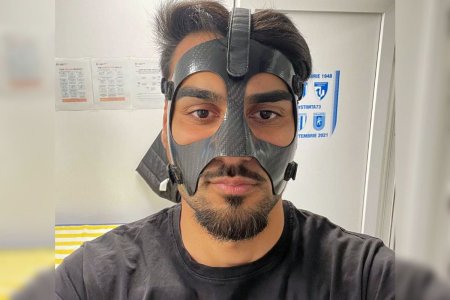 Stefan Zorro Baiaram » Fotbalistul Universitatii Craiova a primit verdictul: cat va fi nevoit sa joace cu masca