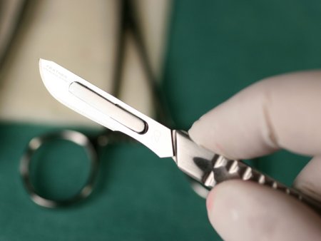 Raport UNICEF: Mutilarea genitala a femeilor continua sa creasca, in ciuda progreselor