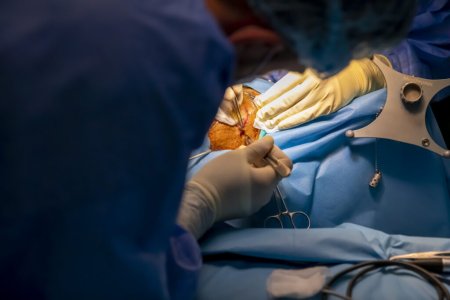 Operatie pe creier prin pleoapa, in premiera nationala, la Spitalul Militar Carol Davila 