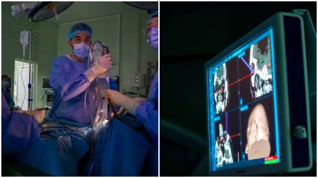 <span style='background:#EDF514'>PREMIERA MEDICALA</span> in Romania: pacient operat pe creier, prin pleoapa, la Spitalul Militar