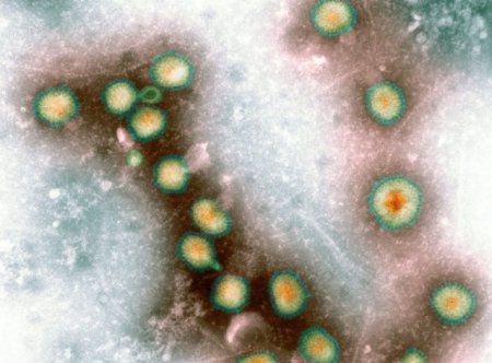Ingrijorari privind o noua tulpina a virusului <span style='background:#EDF514'>H5N1</span>, care omoara si mamifere, nu doar pasari