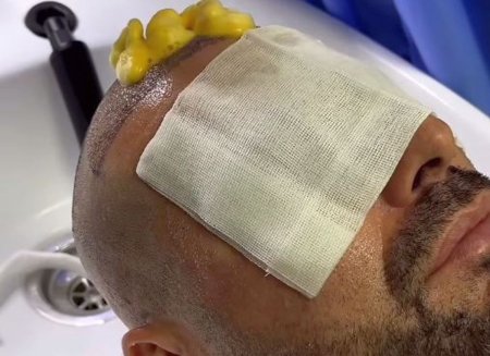 Adrian Mutu, la operatie » Si-a facut implant de par in Turcia: Zici ca-i aveam pe Robert Nita si Messi pe extreme