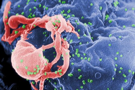 Pas important in lupta impotriva HIV. O noua tehnologie folosita elimina partile ,,rele