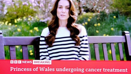Oncolog explica ce este chimioterapia preventiva, dupa ce printesa de Wales a anuntat ca are cancer