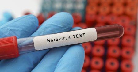 Focar de norovirus la Timisoara, iar cauzele imbolnavirii in masa nu se cunosc. Sunt 86 de copii si 20 de profesori bolnavi