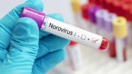 Elevii si profesorii de la un colegiu din Timisoara, ajunsi la spital intoxicati, au aflat cauza: Este focar de Norovirus