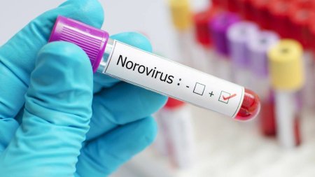 Elevii si profesorii de la un colegiu din Timisoara, ajunsi la spital <span style='background:#EDF514'>INTOXICATI</span>, au aflat cauza: Este focar de Norovirus