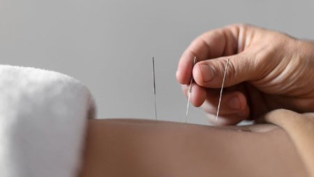 <span style='background:#EDF514'>ACUPUNCTURA</span>, o metoda terapeutica antica. Beneficii si afectiuni tratate