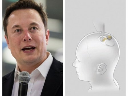 Lupta pentru cipurile din cap. Un rival al companiei lui Elon Musk pregateste testarea unui implant cerebral