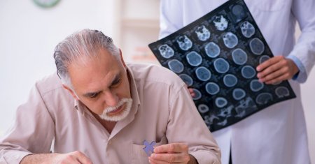 Studiul care poate ajuta la diagnosticarea timpurie a bolii Alzheimer! Descoperirea inedita a specialistilor