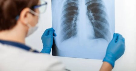 Ce este radonul, gazul radioactiv responsabil de cresterea alarmanta a cancerului pulmonar in randul nefumatorilor