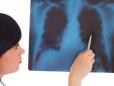 Cancerul pulmonar ameninta si ne<span style='background:#EDF514'>FUMAT</span>orii. Vinovat este radonul, o substanta radioactiva prezenta in sol