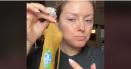 Noul trend pe TikTok: coaja de banana, folosita ca botox natural. Ce spun dermatologii VIDEO