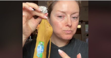 Noul <span style='background:#EDF514'>TREND</span> pe TikTok: coaja de banana, folosita ca botox natural. Ce spun dermatologii VIDEO