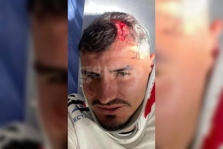 Imagine horror cu Romario Benzar dupa faultul lui Abdallah » Care e starea fundasului + Alti doi de la FC Botosani au avut de suferit