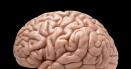 Creierul uman poate deveni mai mare in timp. Ce au descoperit <span style='background:#EDF514'>CERCETAT</span>orii