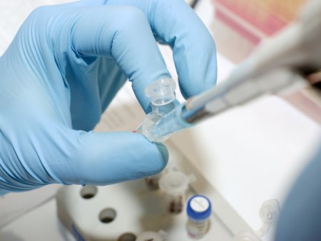 Primul vaccin impotriva melanomului, testat in Marea Britanie. Foloseste tehnologia ARN mesager