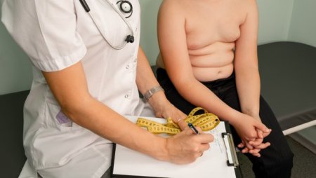 A fost descoperita gena obezitatii la copii