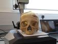 Un craniu egiptean vechi de 4.000 de ani dezvaluie indicii despre posibile tratamente impotriva cancerului